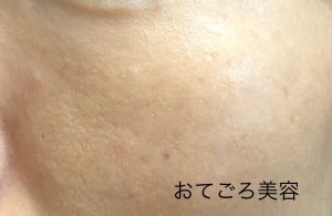 ラスターフィニッシュを塗った写真